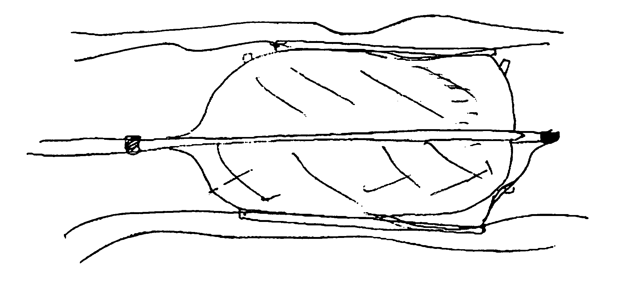 Thermally pliable and carbon fiber stents