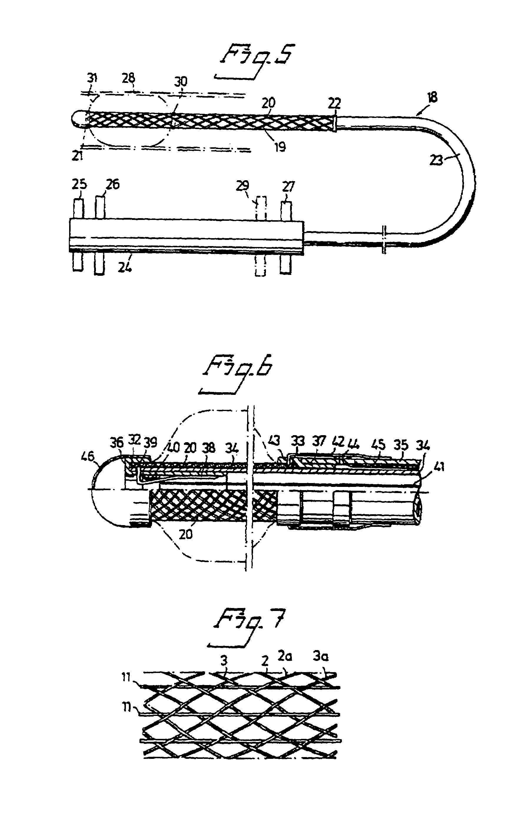 Thermally pliable and carbon fiber stents