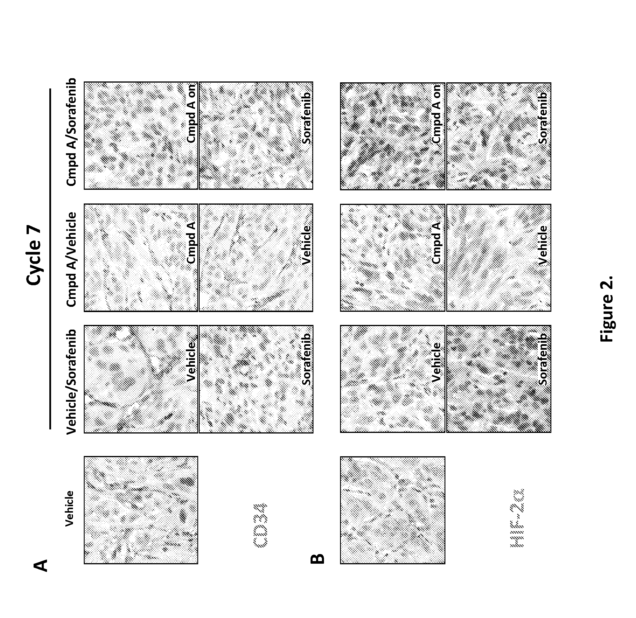 Treatment regimens using multiple pharmaceutical agents