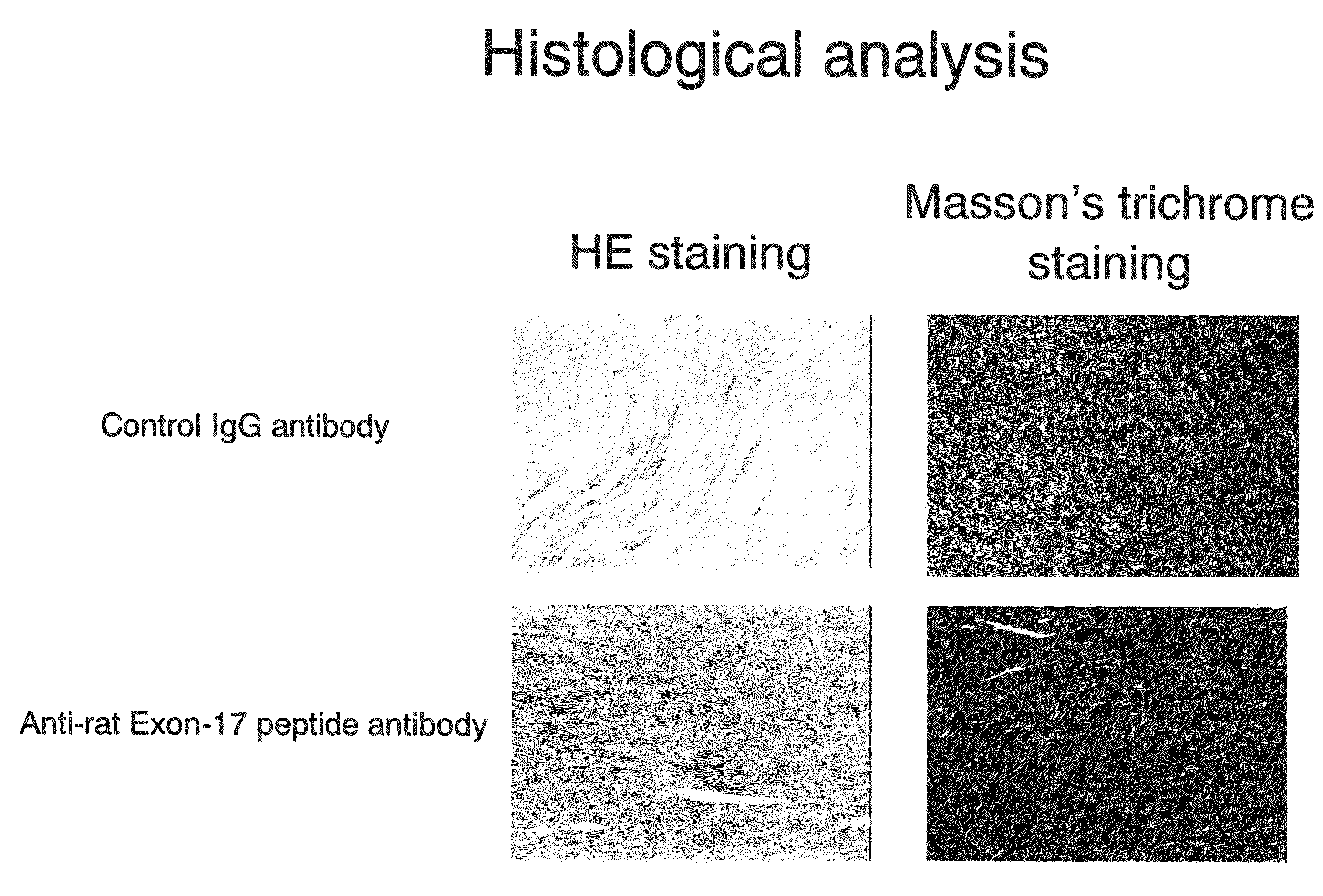 Antibody Against Periostin, and a Pharmaceutical Composition comprising it for Preventing or Treating a Disease in which Periostin is Involved