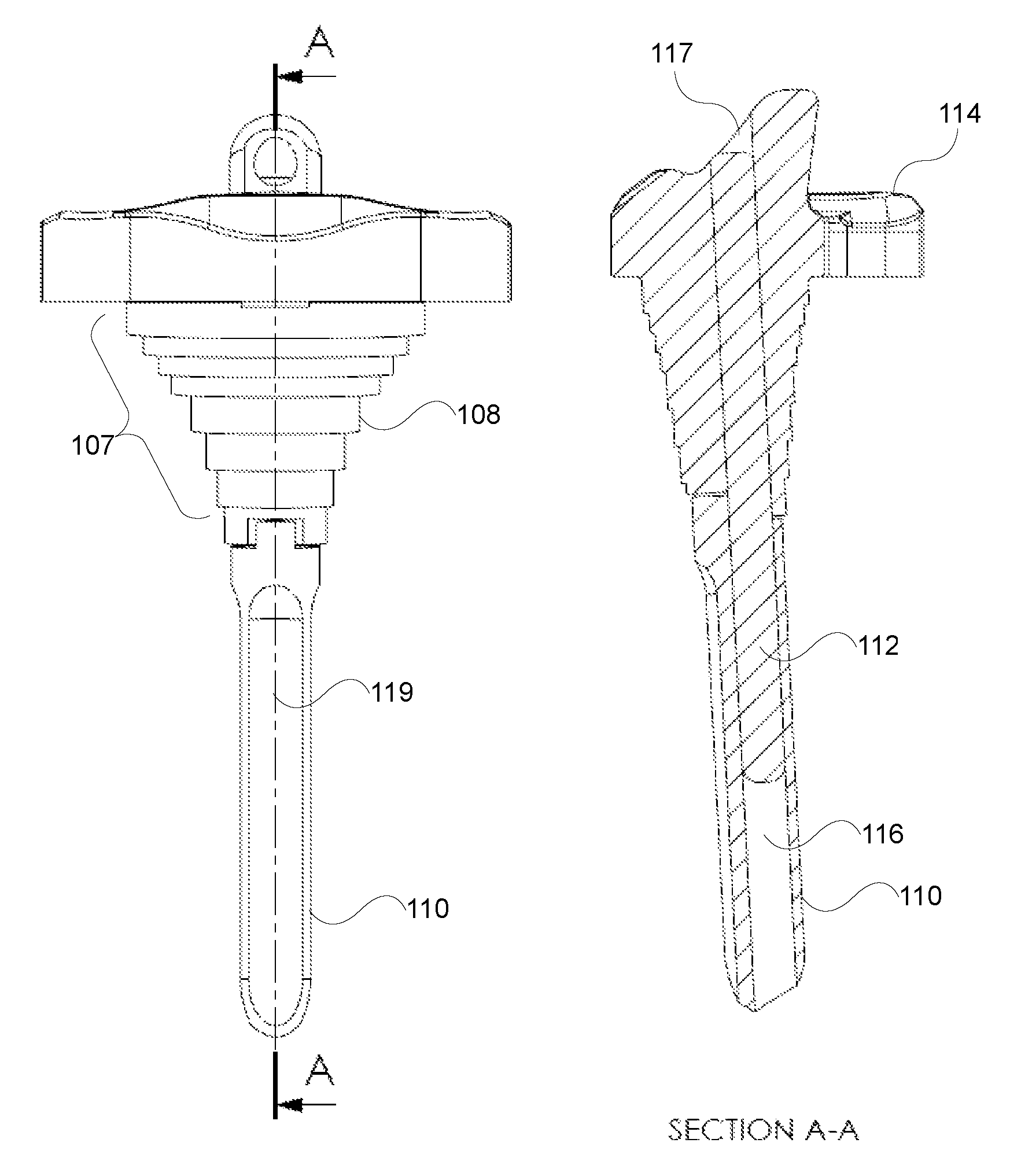 Implant system for knee prosthesis