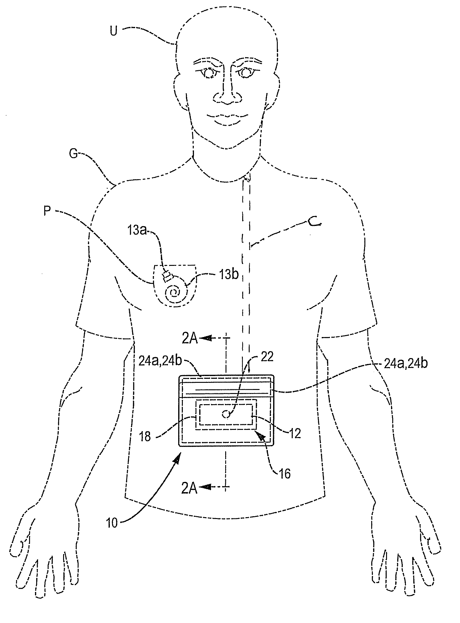 User object securing assembly