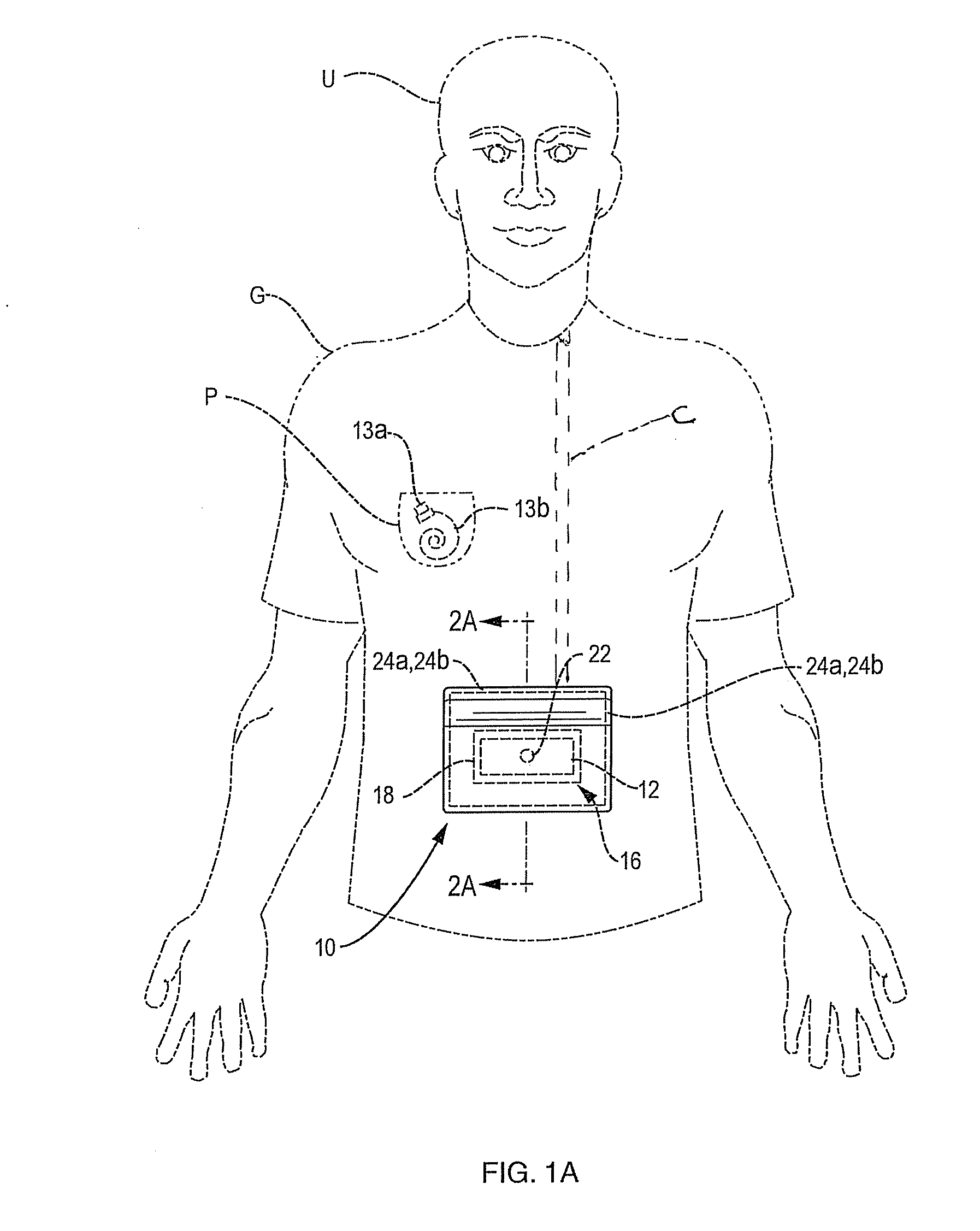 User object securing assembly