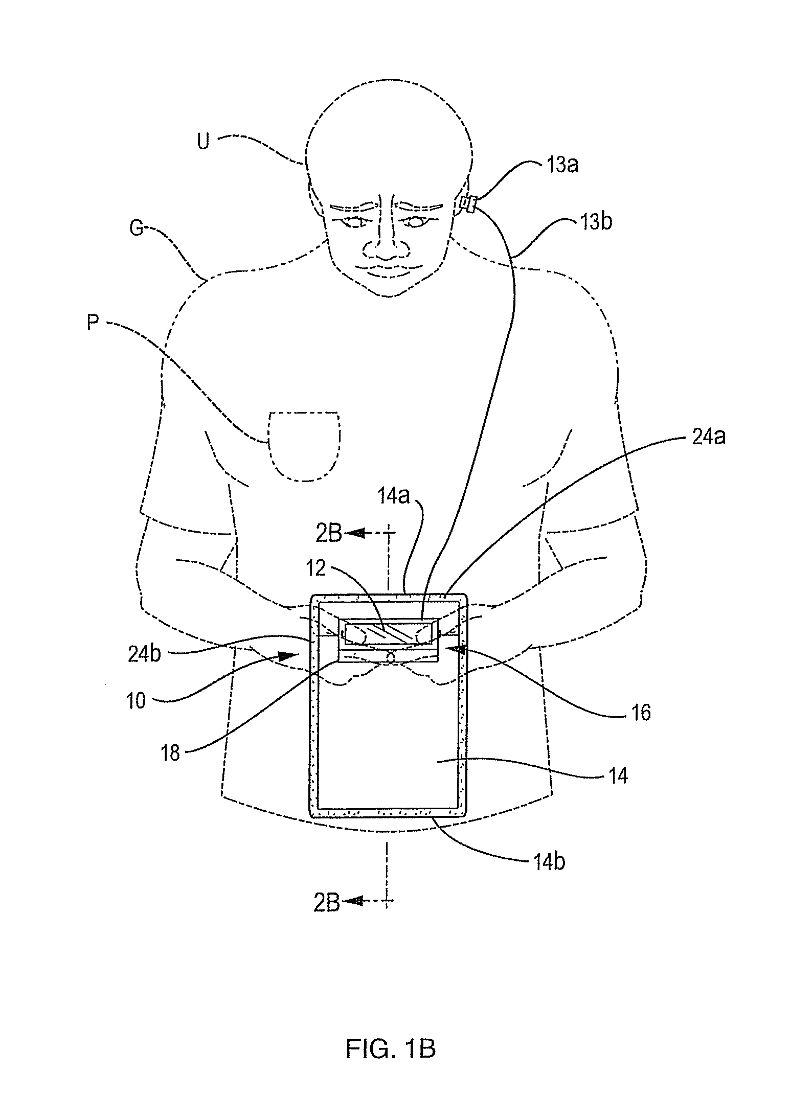 User object securing assembly