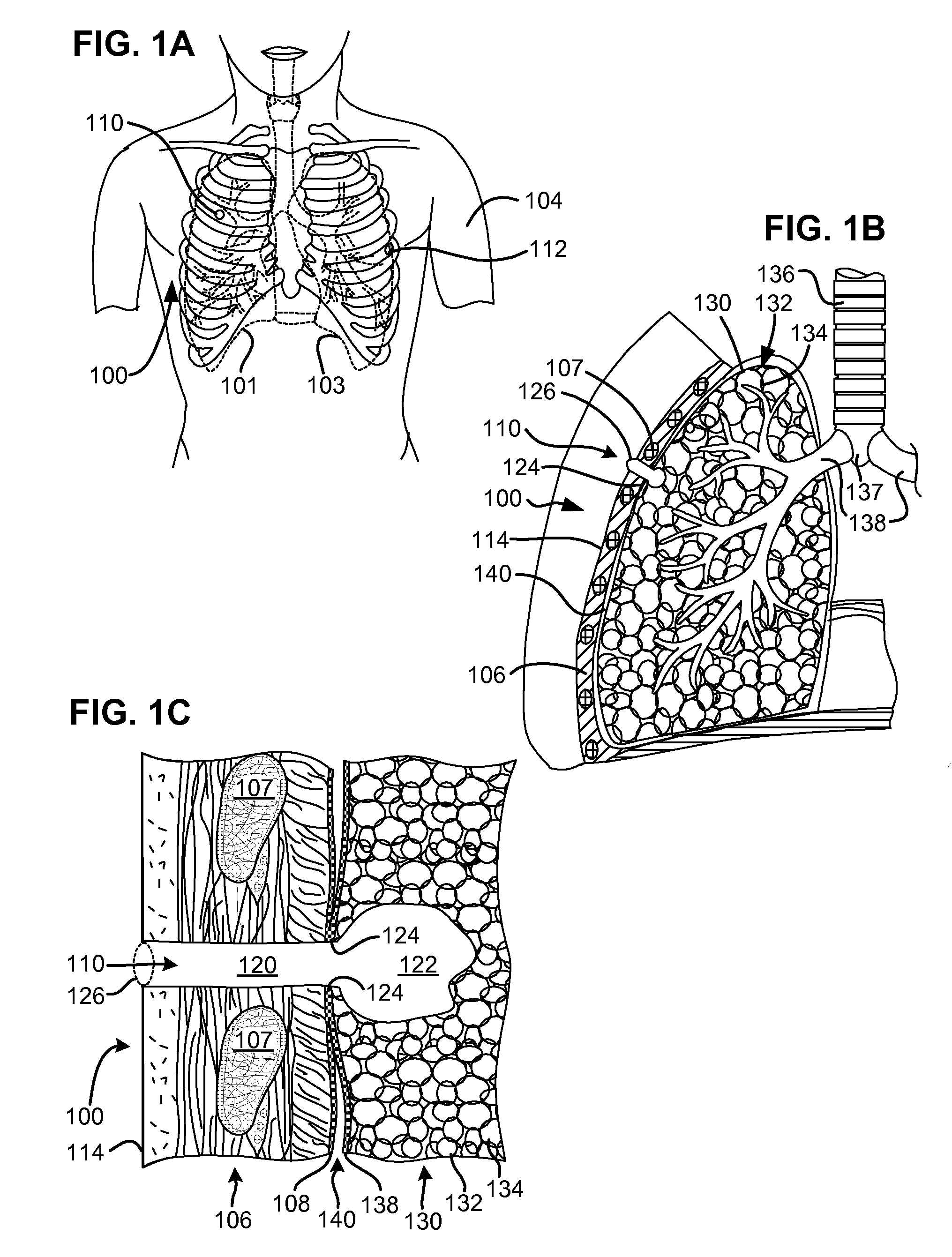 Methods and devices for follow-up care and treatment of a pneumostoma