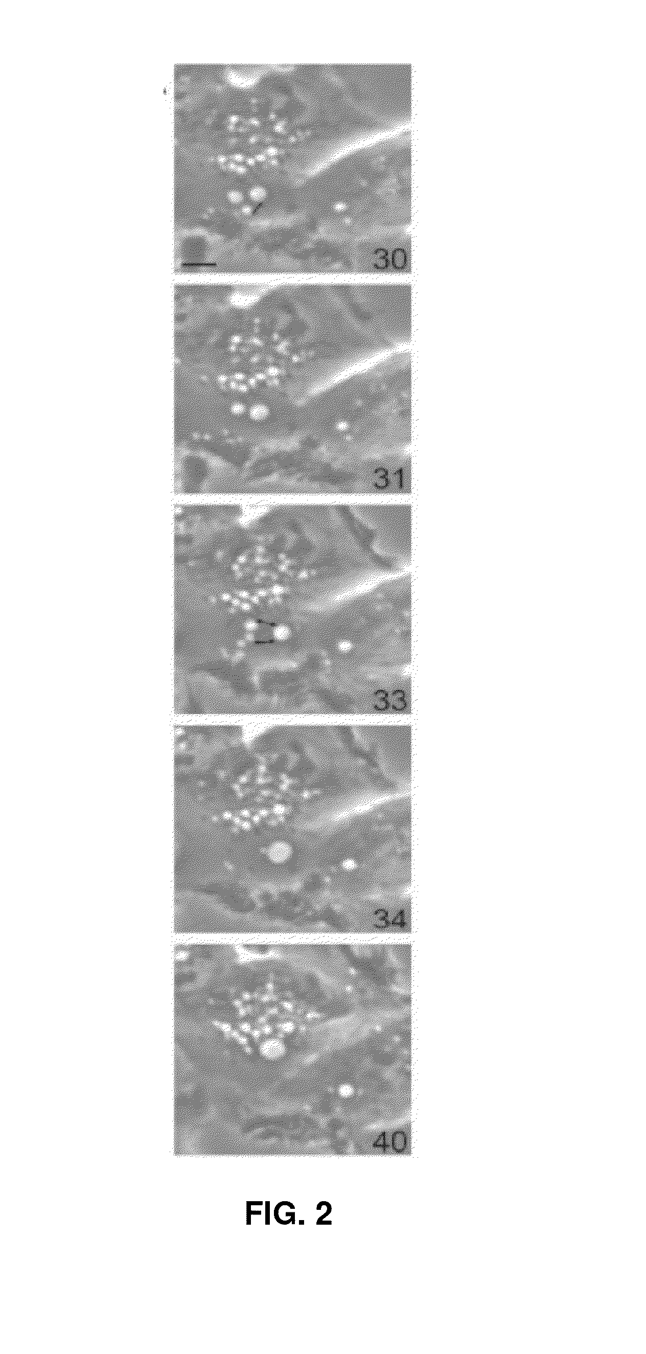 Materials and Methods Useful to Induce Vacuolization, Cell Death, or a Combination Thereof