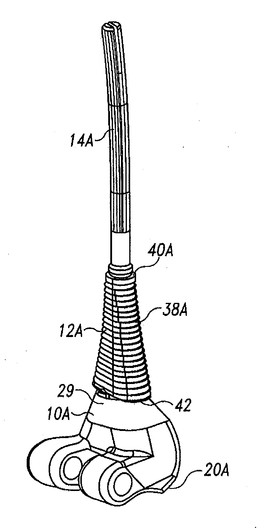 Modular implant system with fully porous coated sleeve