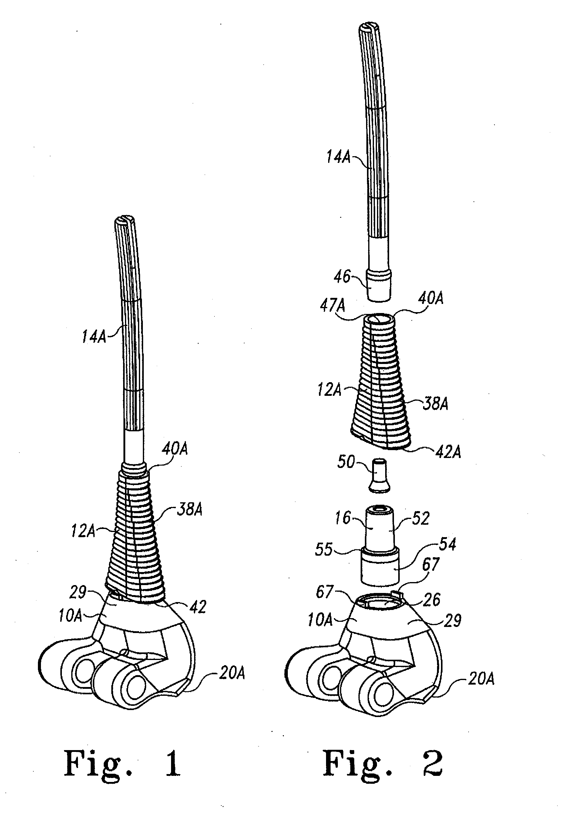 Modular implant system with fully porous coated sleeve