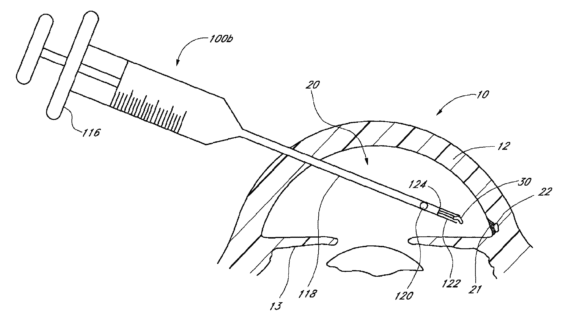 Implants with controlled drug delivery features and methods of using same