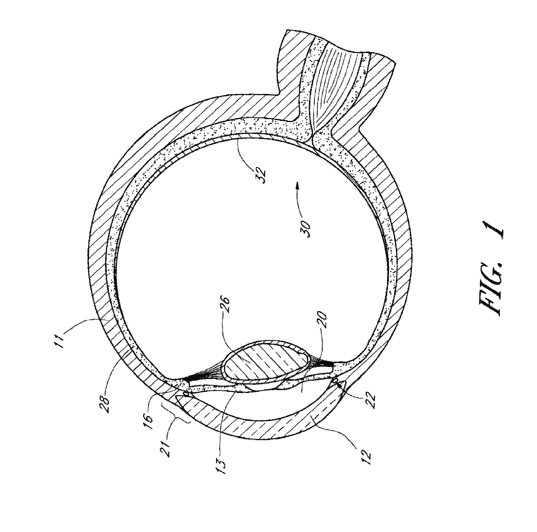 Implants with controlled drug delivery features and methods of using same