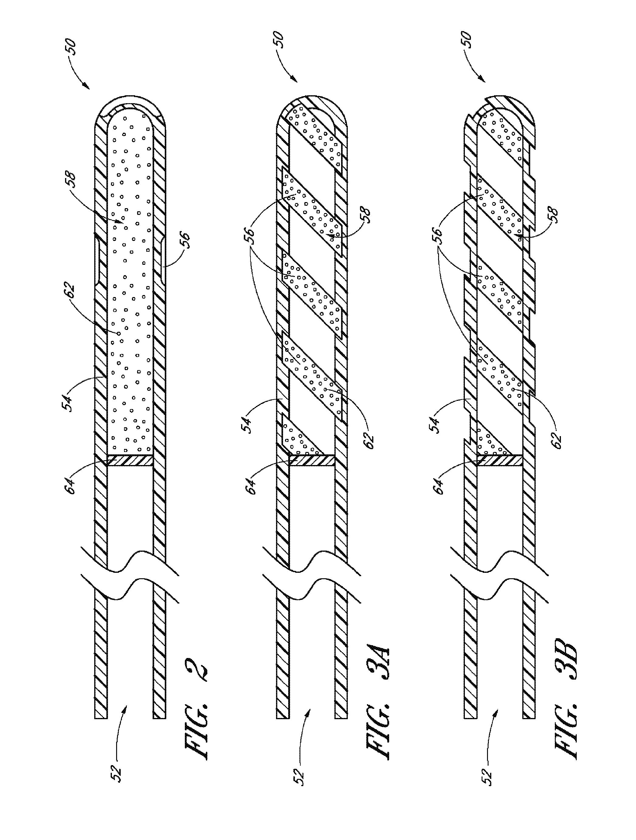 Implants with controlled drug delivery features and methods of using same