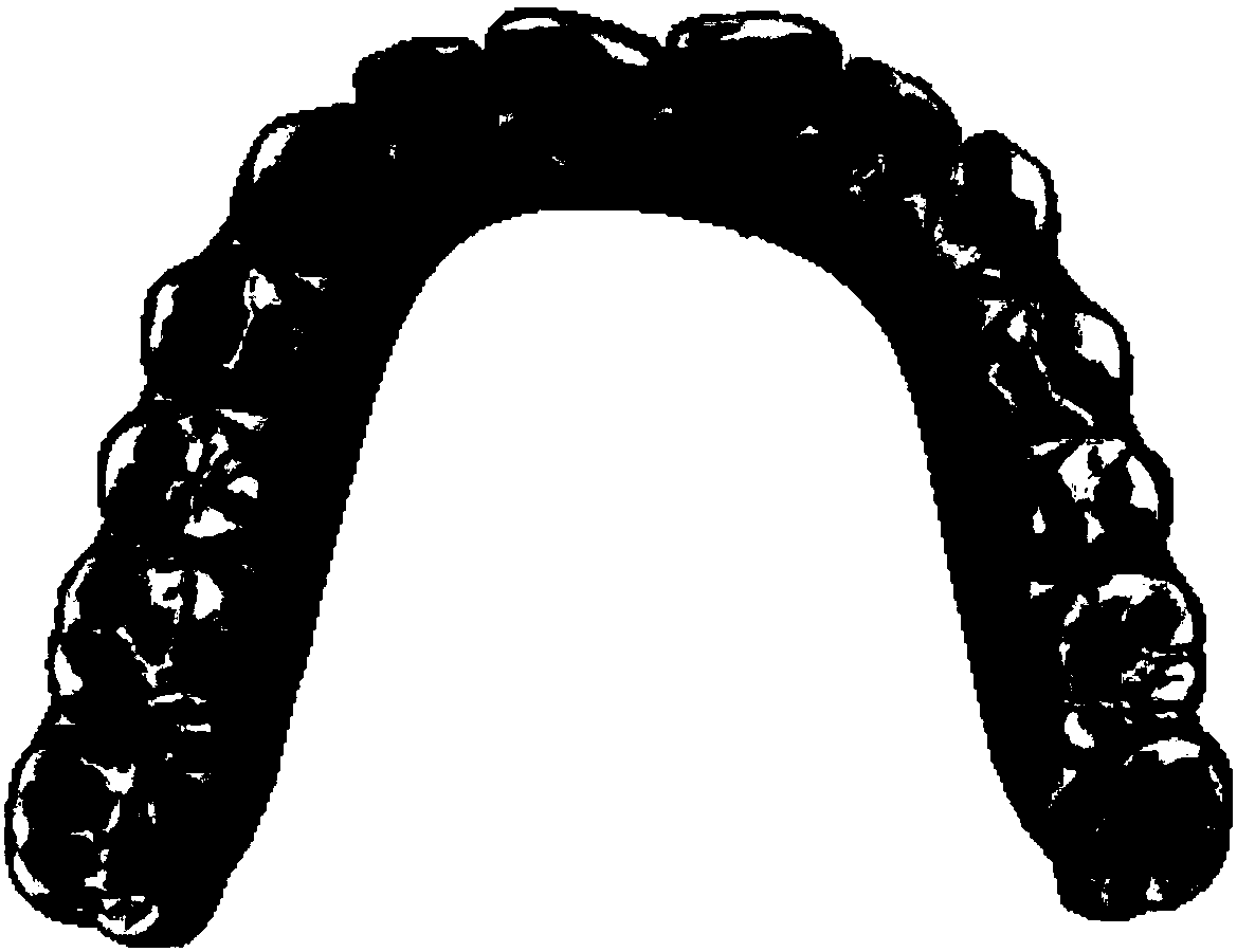 A Collision Detection Method for the Calculation of Upper and Lower Jaw Occlusal Areas