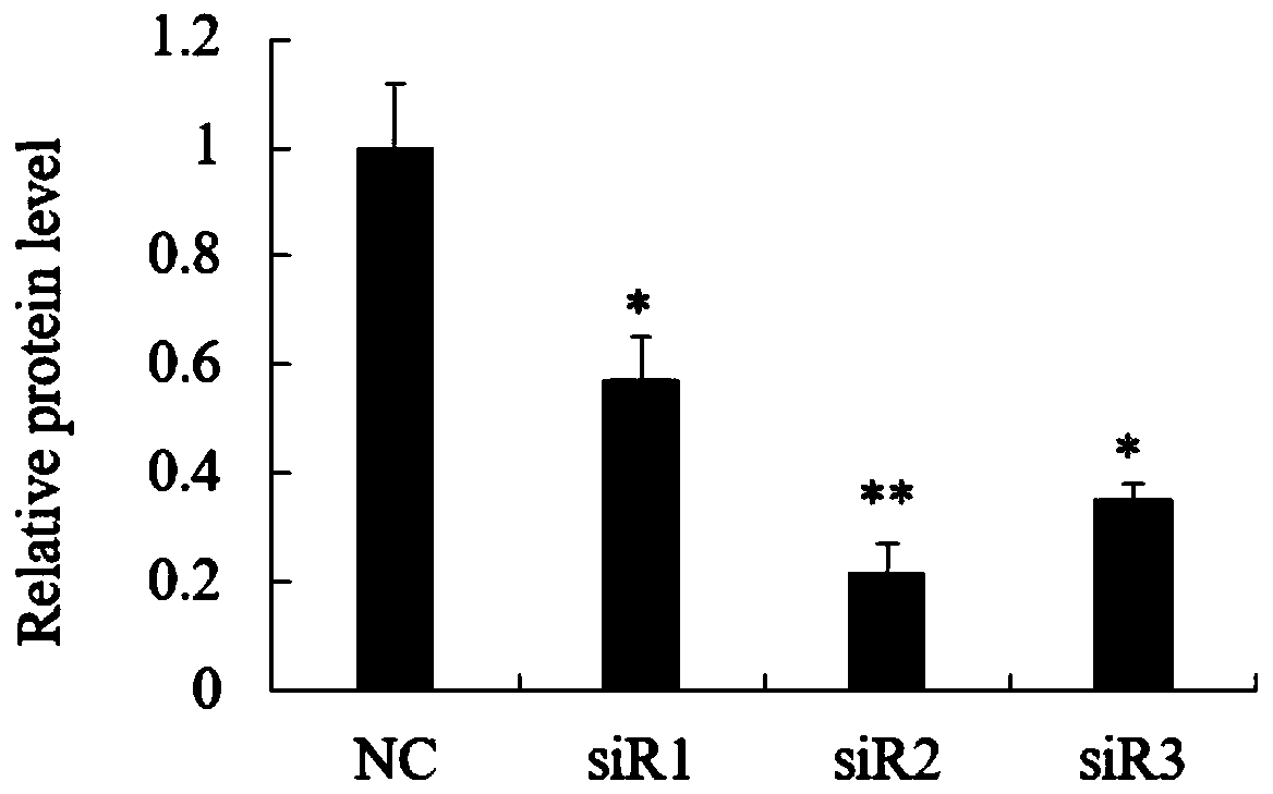 siRNA interfering Mroh7 gene expression and application, interfering method and drug thereof