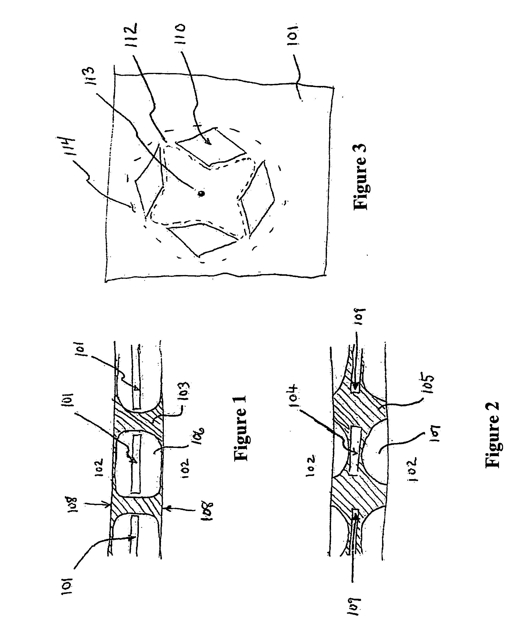 Prosthetic for tissue reinforcement