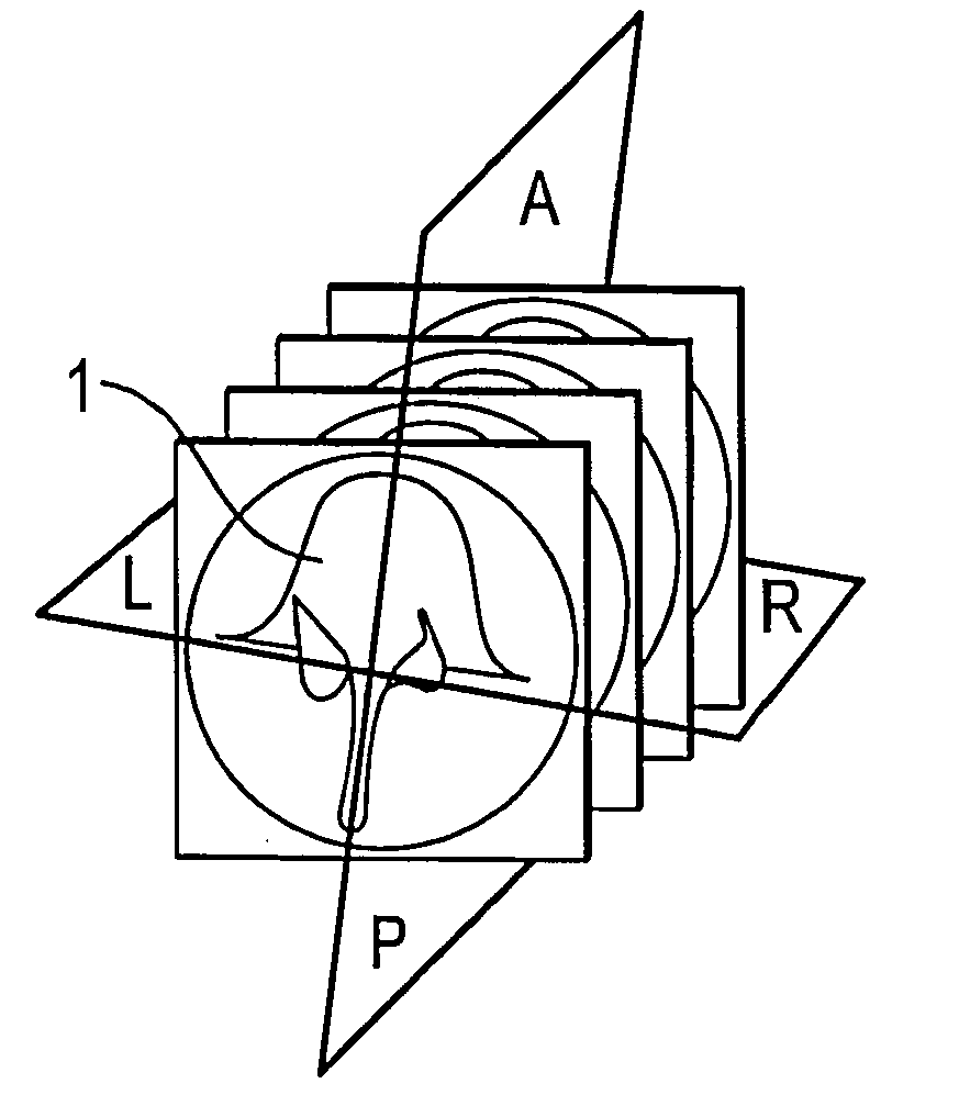 Method for verifying the relative position of bone structures