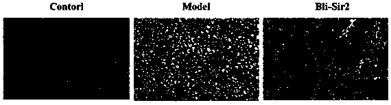 Bacillus licheniformis (BL)3 Silence information regulator (Sir)2-like protein capable of relieving nonalcoholic fatty liver disease (NAFLD) tissue lesions and application of BL3 Sir2 protein