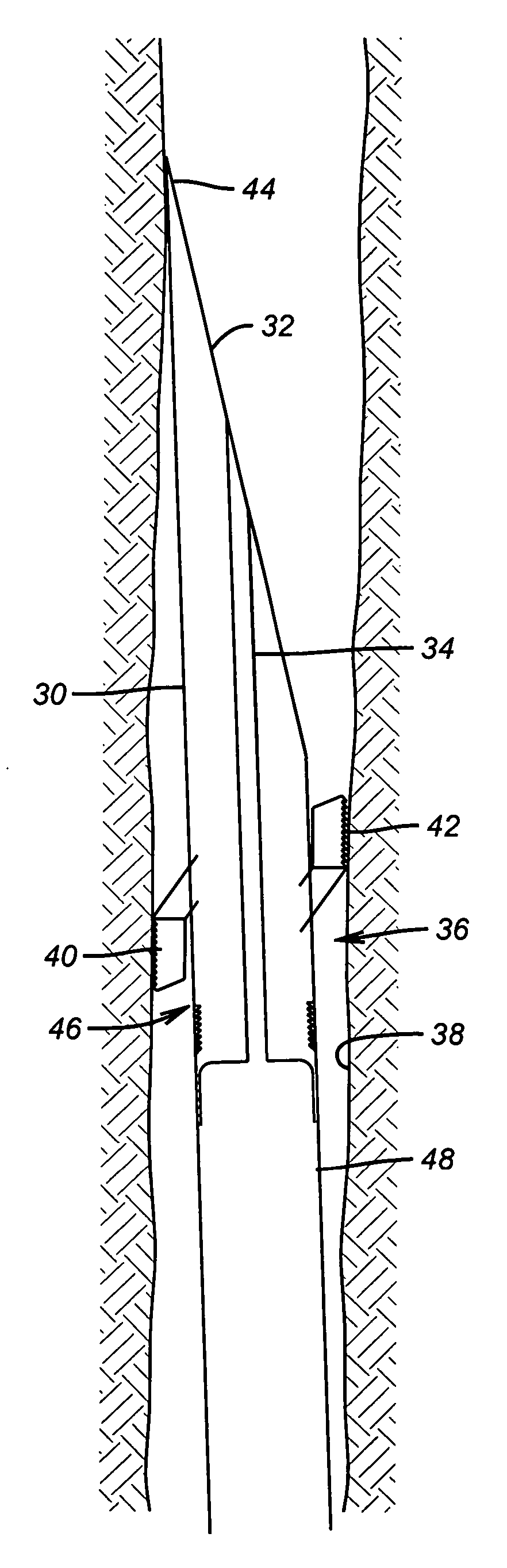 Downhole/openhole anchor