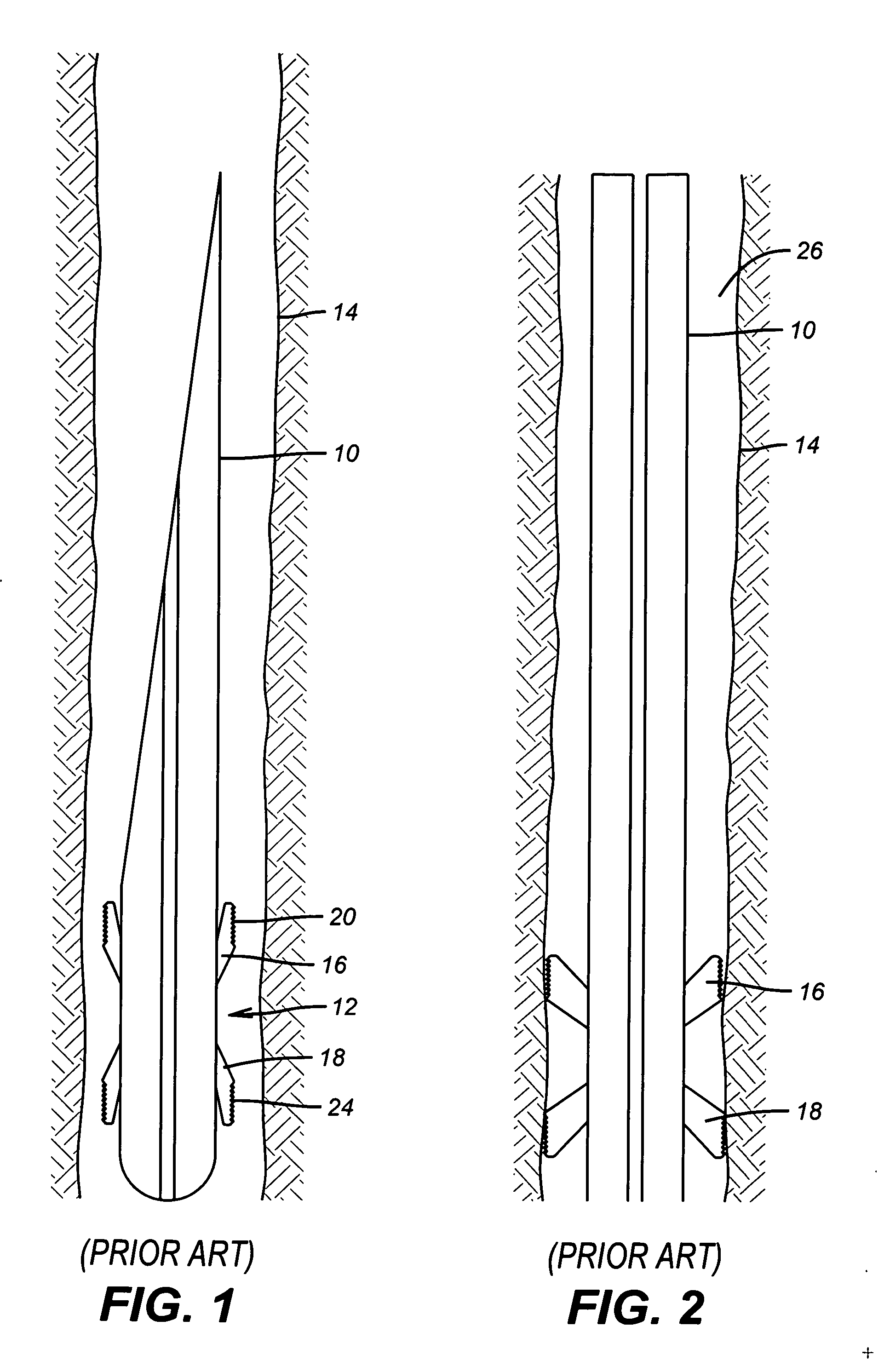 Downhole/openhole anchor