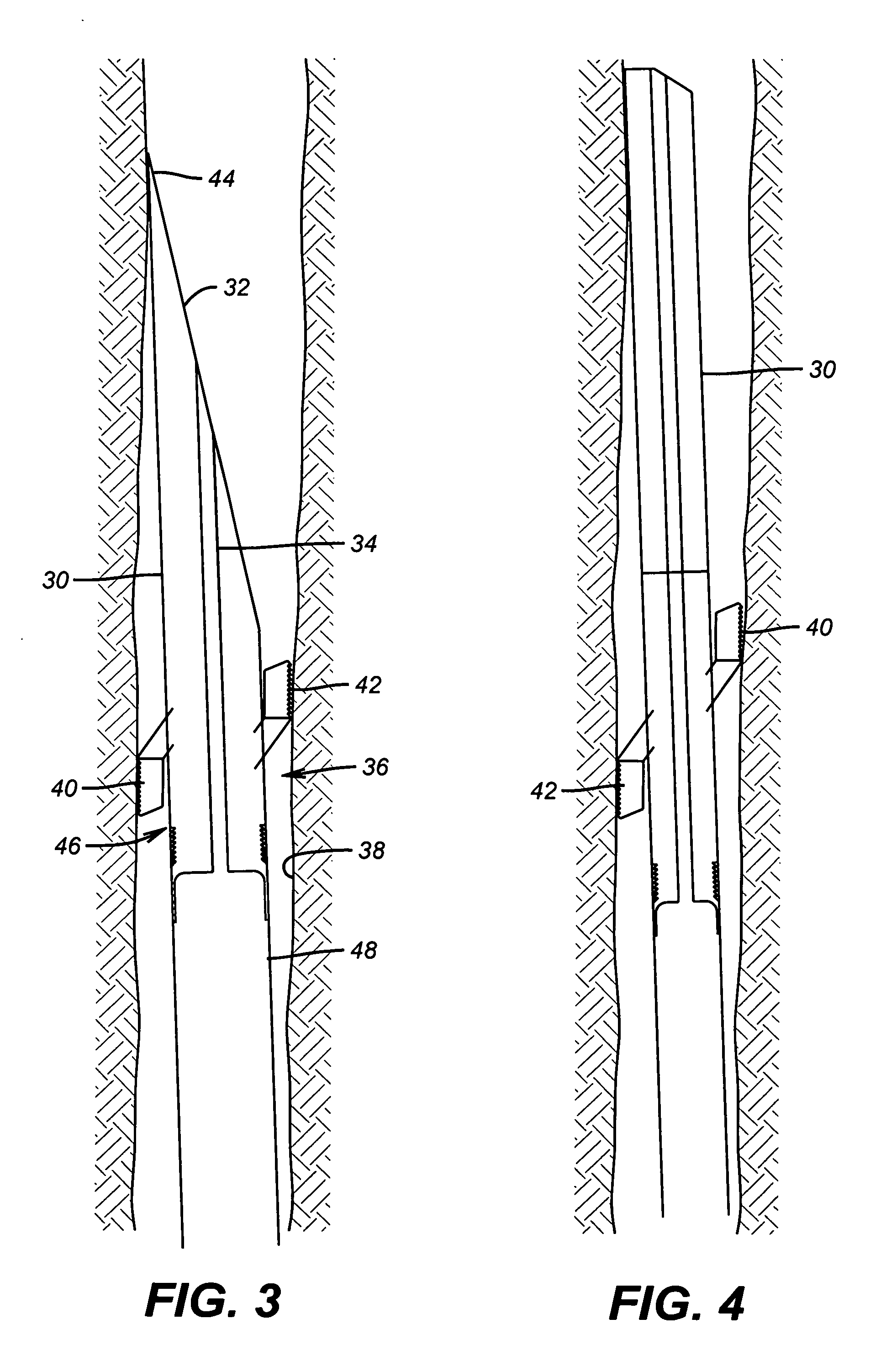 Downhole/openhole anchor