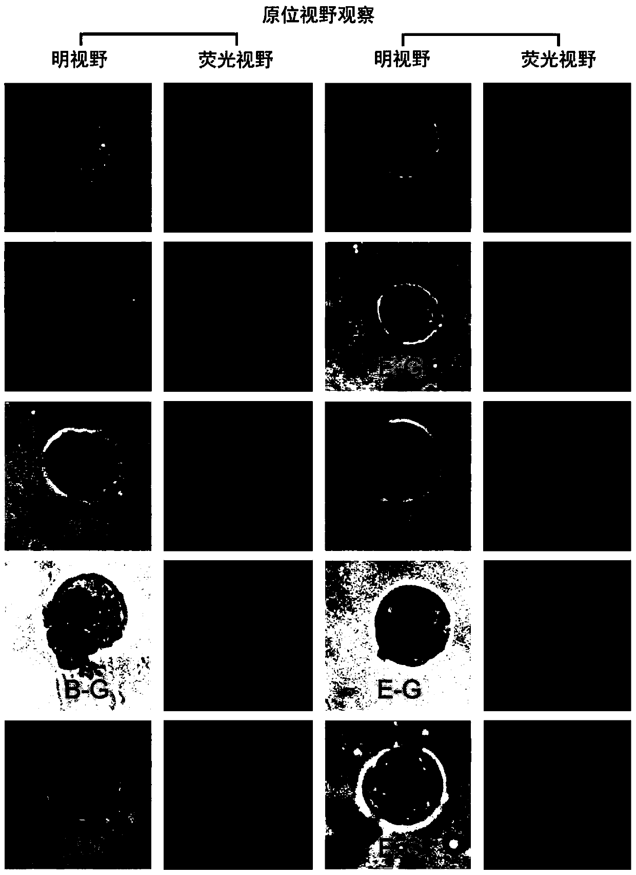 Method used for detecting ostrea plicatula eosinophilic and basophilic granulocyte phagocytic ability