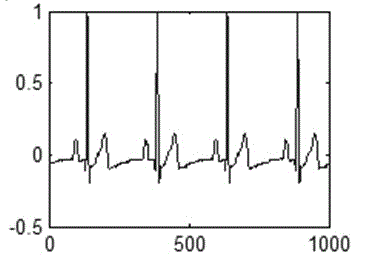 Electrocardiosignal preprocessing method based on morphological multiresolution decomposition