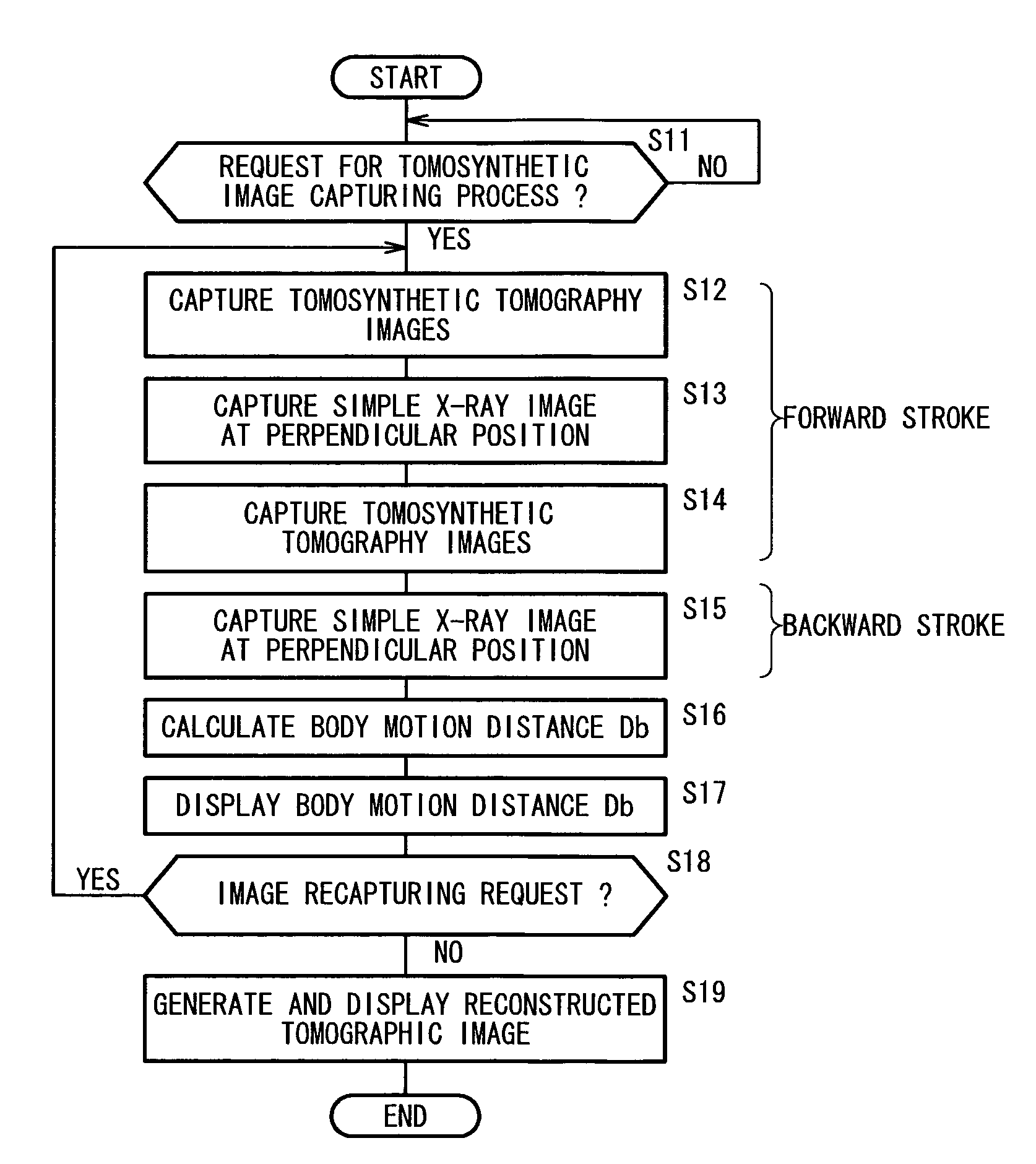 Radiographic tomography apparatus