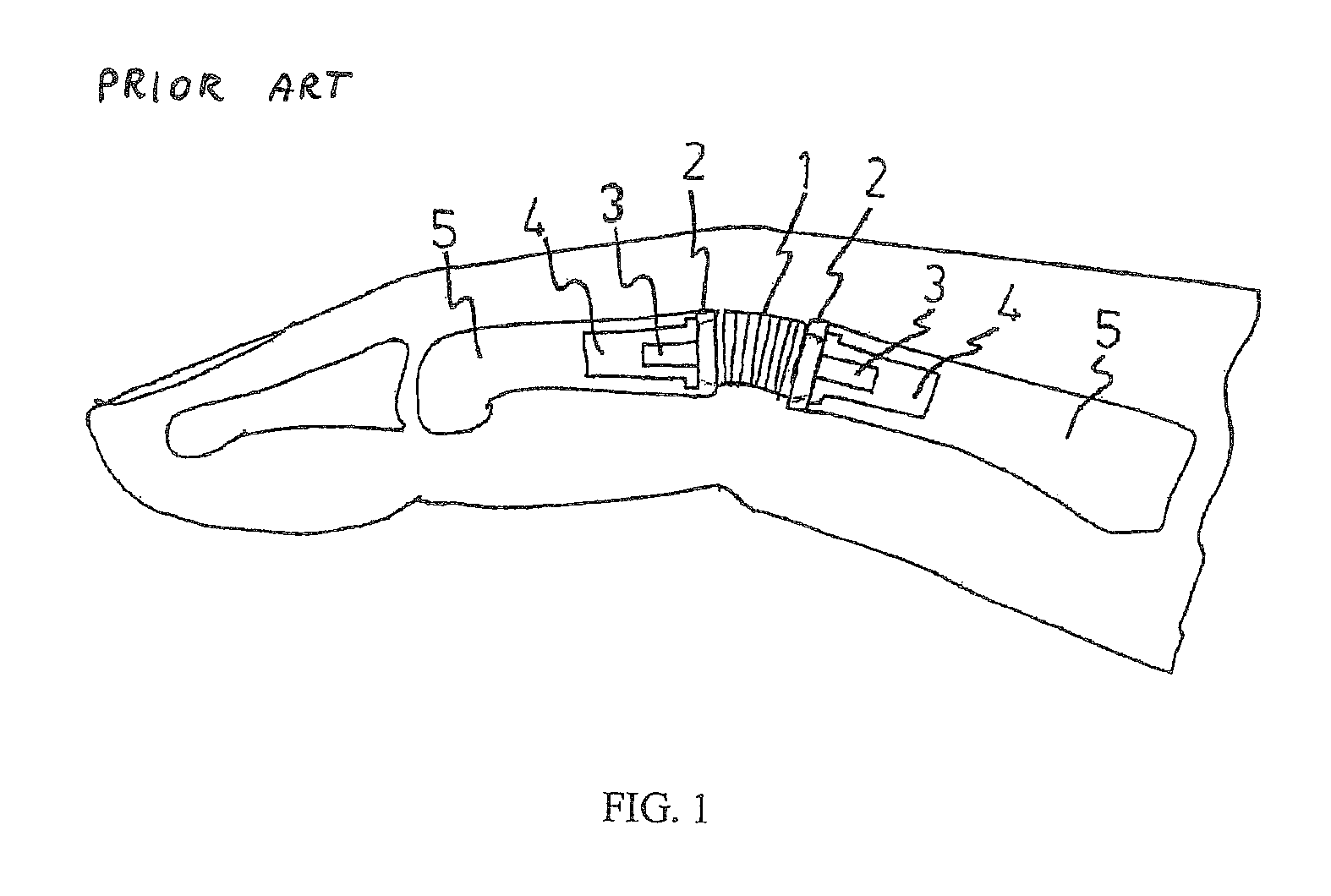 Artificial joint