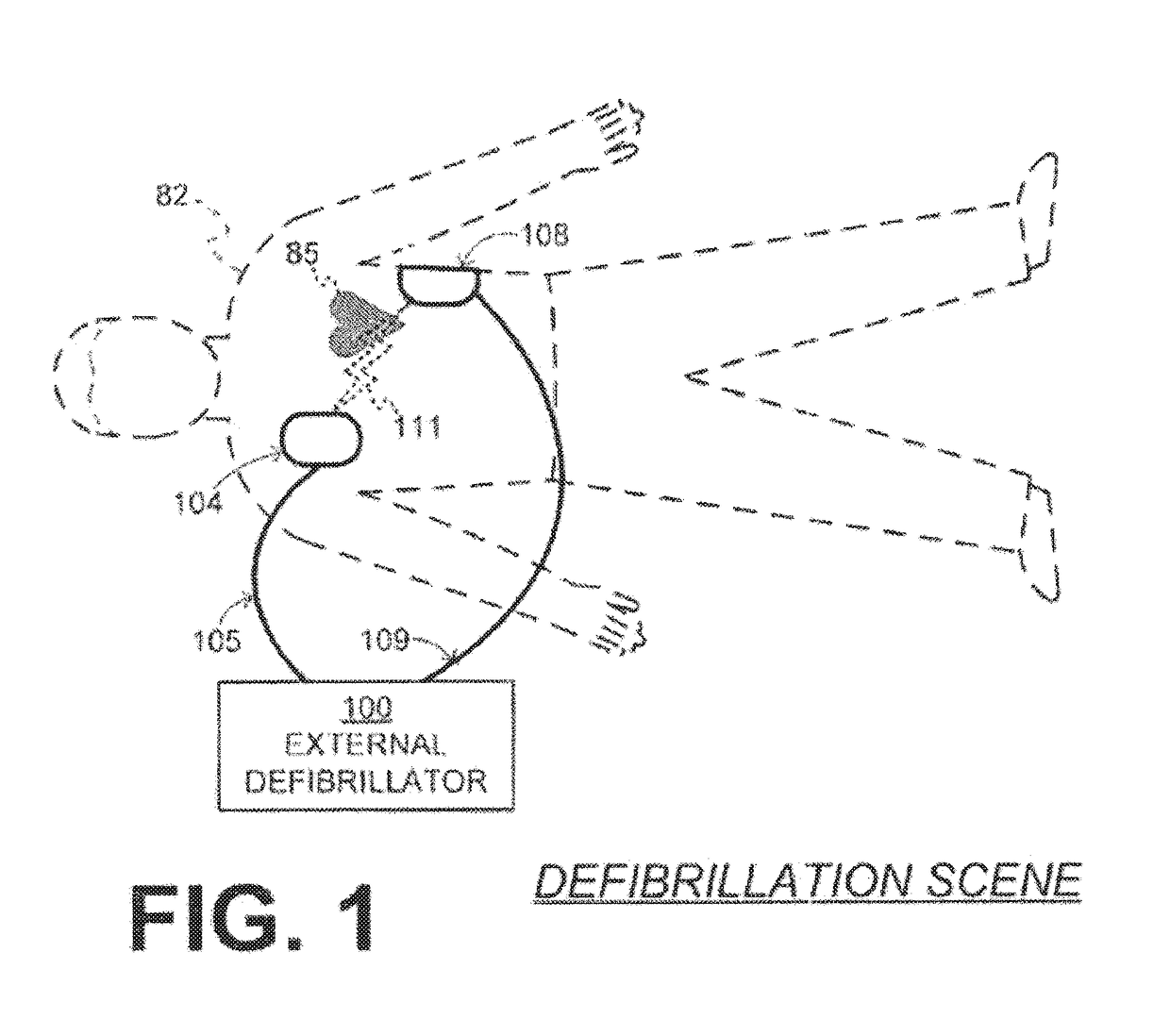 Variable sound system for medical devices