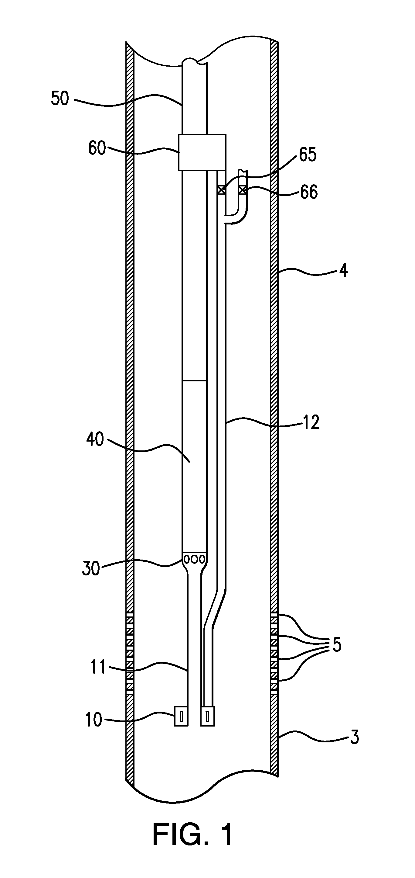 Wellbore desanding system