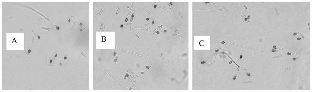 Induced destruction of anthracnose spore-forming medium, preparation method and method for inducing spore-forming