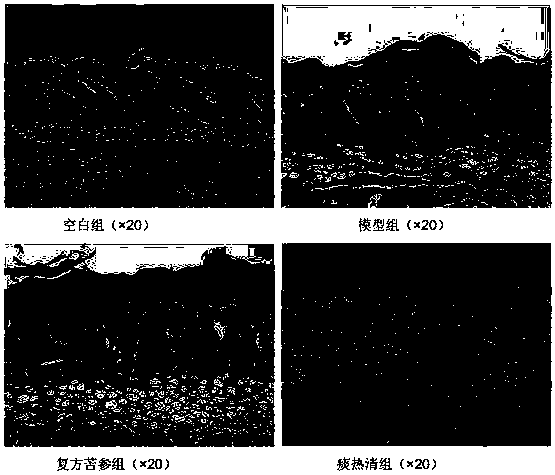 Novel pharmaceutical use of Tanreqing