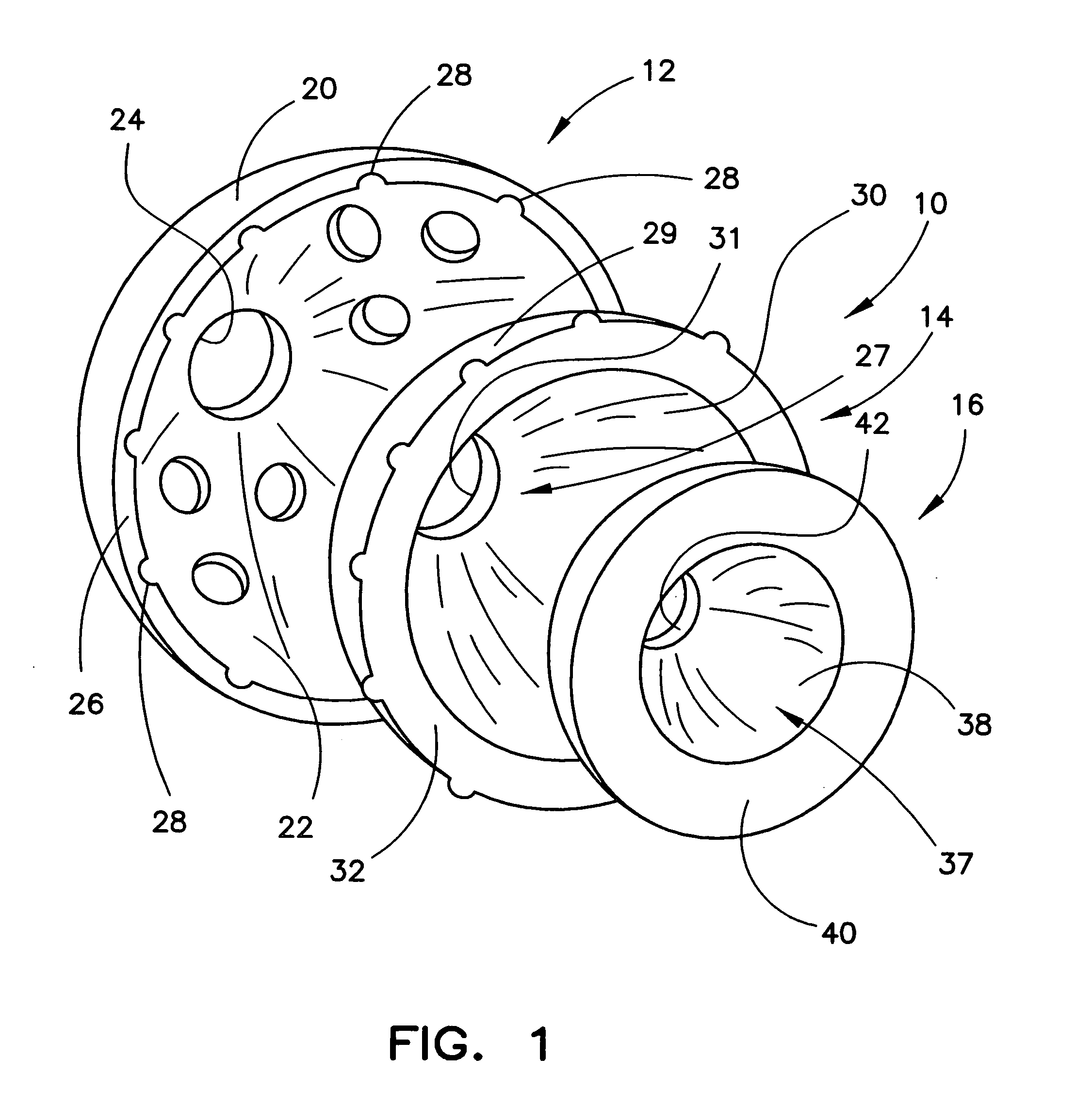 Modular orthopaedic implant apparatus