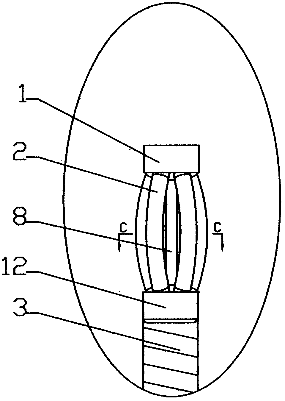 Multi-functional stone extractor