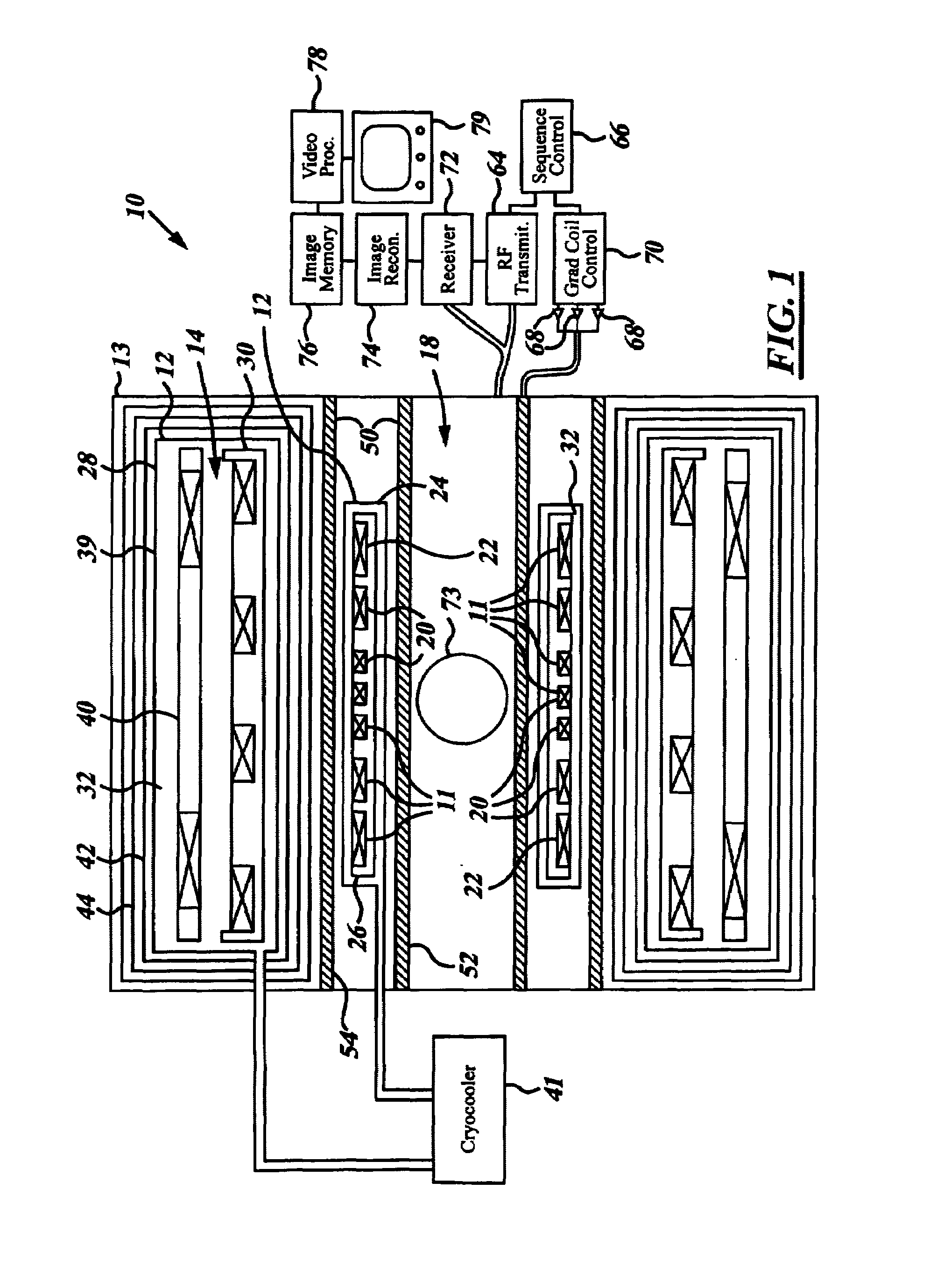 MRI system utilizing supplemental static field-shaping coils