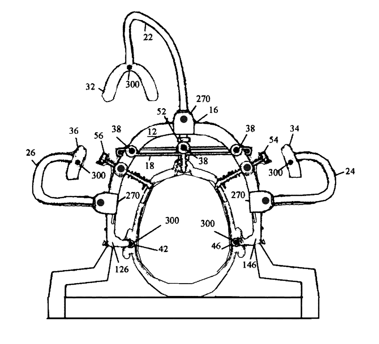 Method and device for positioning and stabilization of bony structures during maxillofacial surgery