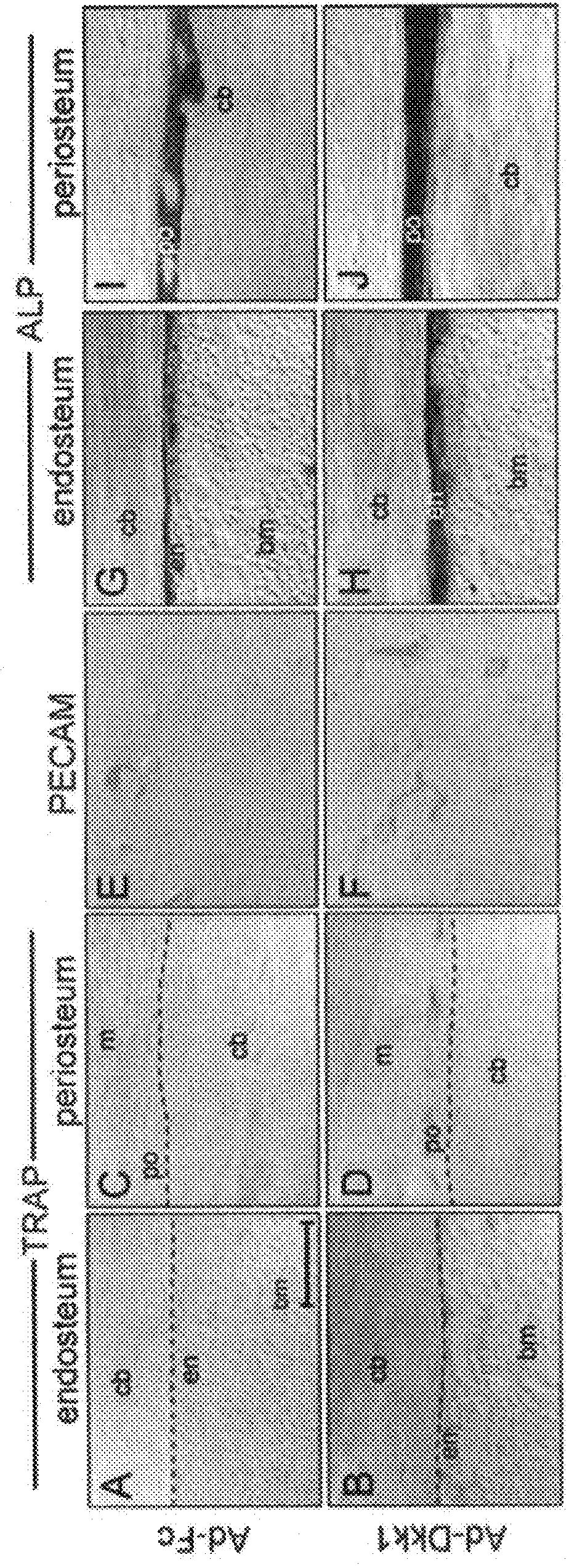 Use of liposomal WNT composition to enhance Osseointegration