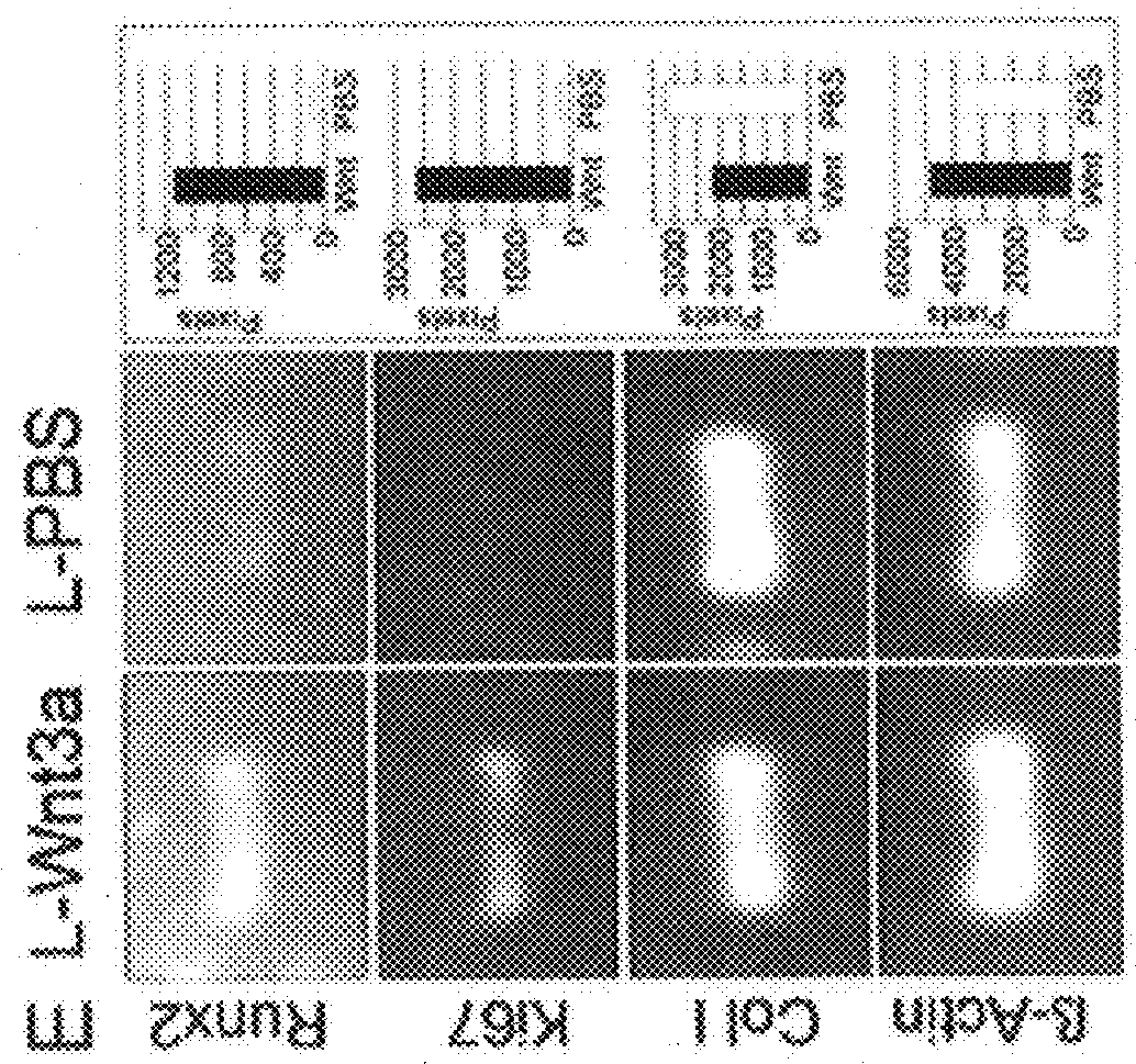 Use of liposomal WNT composition to enhance Osseointegration