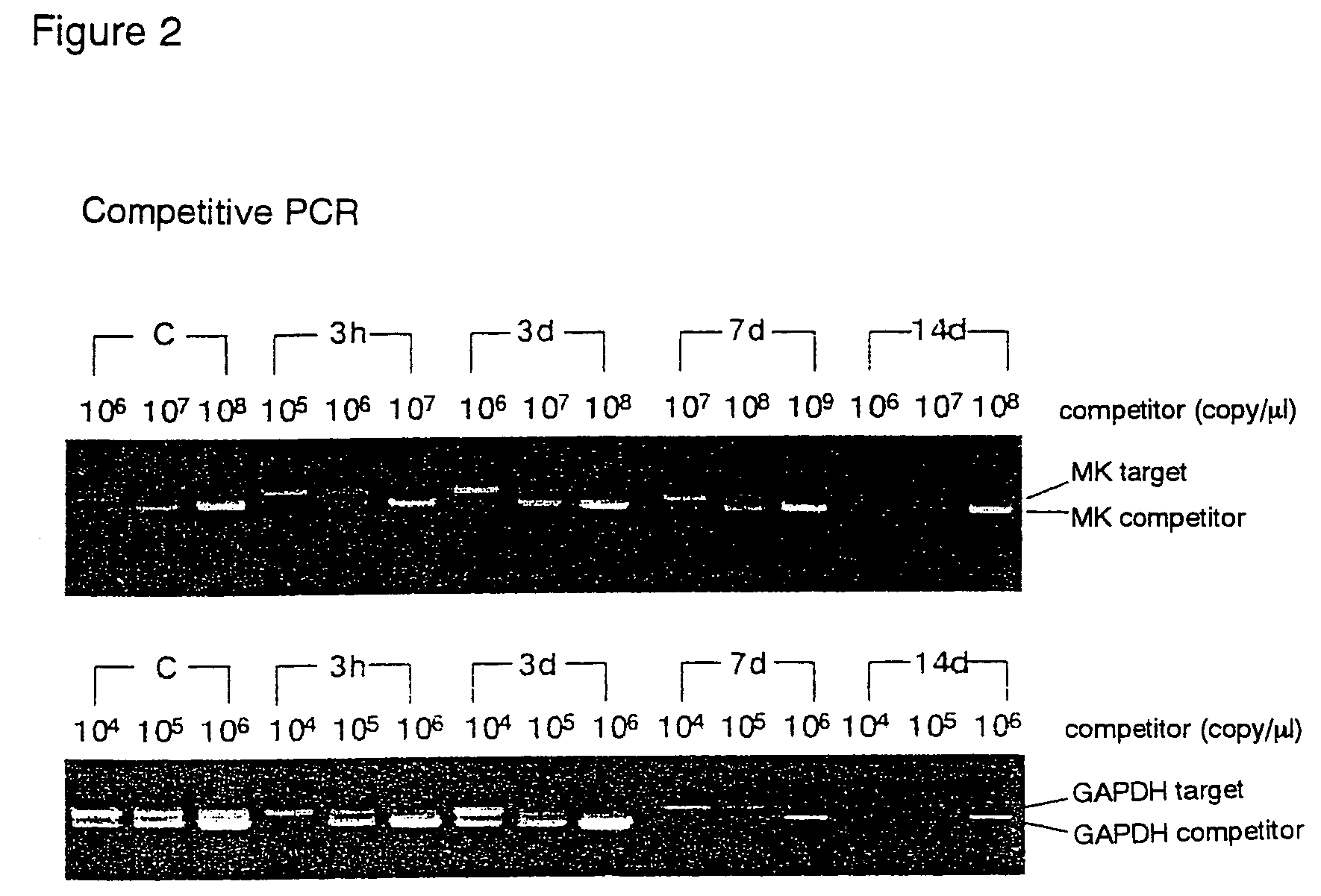 Pharmaceutical compositions for the prevention and treatment of atherosclerosis and restenosis after PTCA