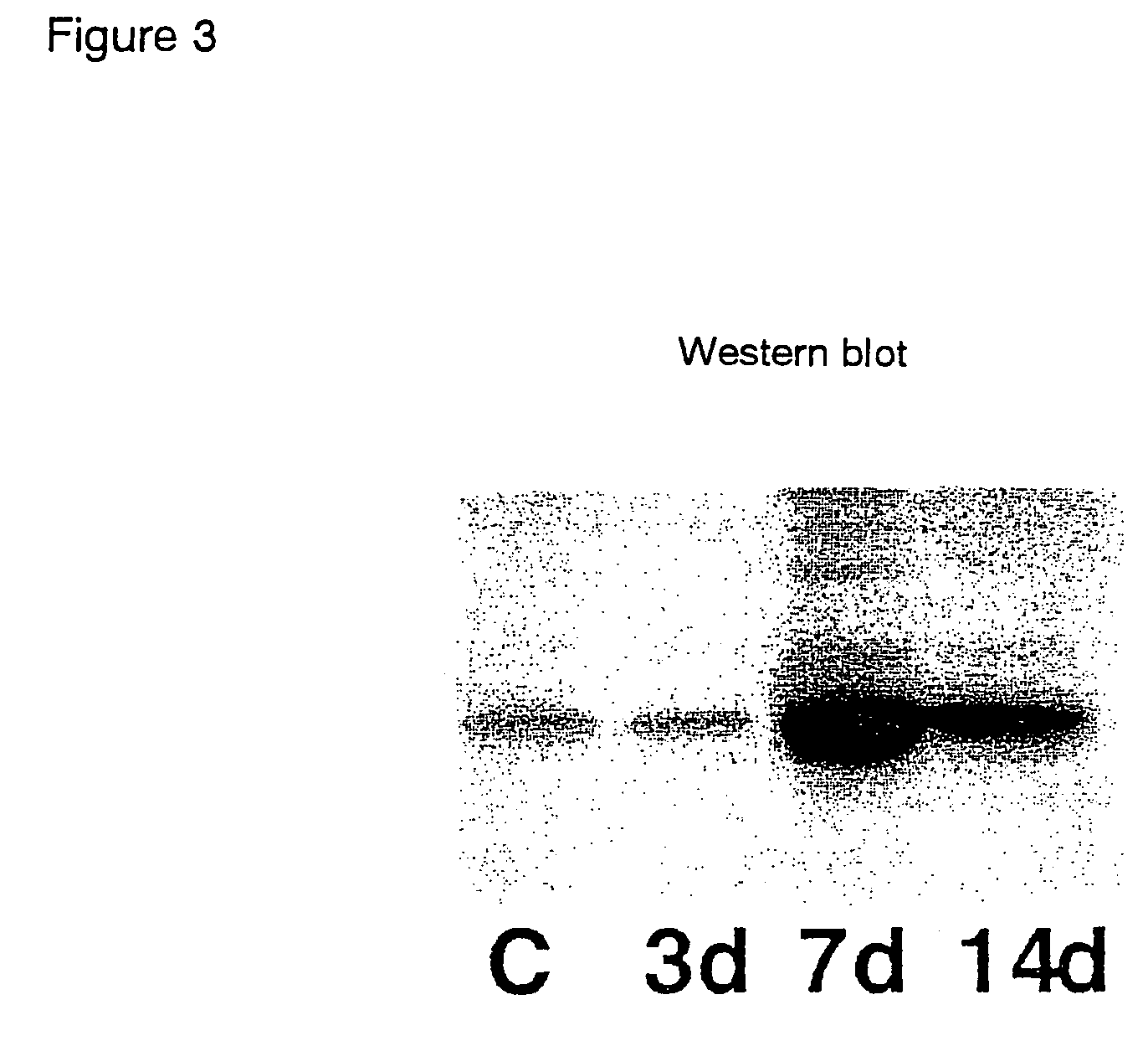 Pharmaceutical compositions for the prevention and treatment of atherosclerosis and restenosis after PTCA