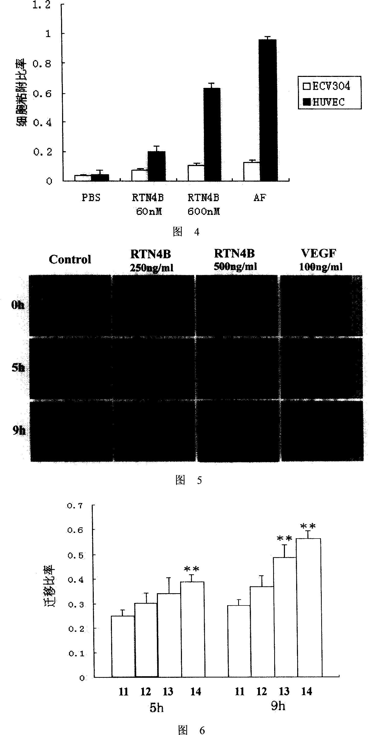 Application of human RTN4B protein in preparation of medicine for healing wound