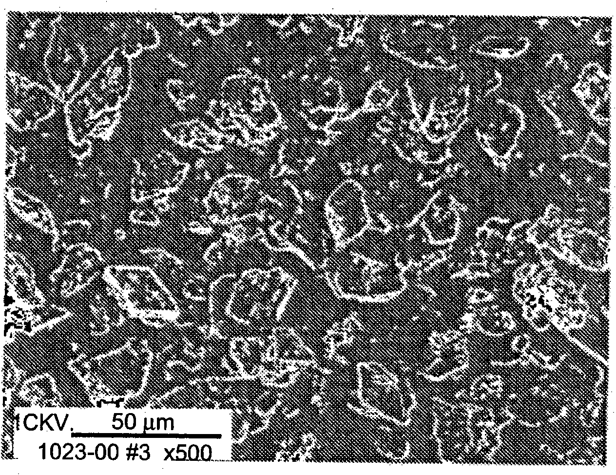 Pulmonary delivery of spherical insulin microparticles