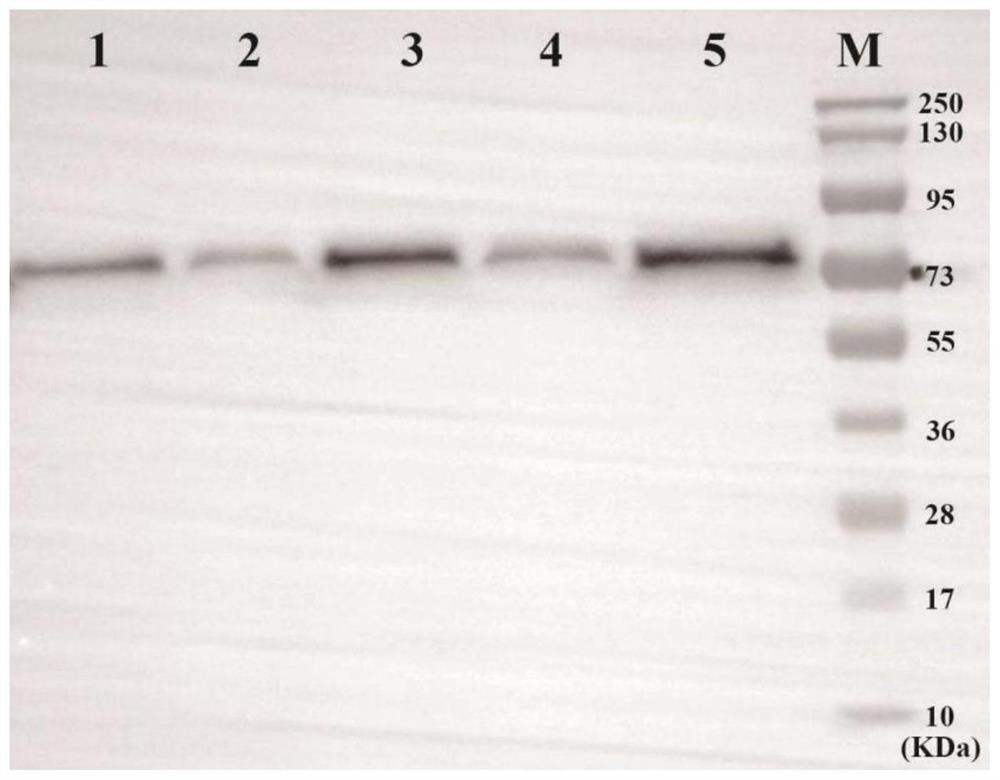 A method for screening non-integrating attenuated Listeria strains highly expressing foreign proteins