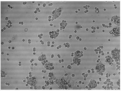 Method of preparing mink canine distemper antigen-protein composite, the antigen-protein composite and applications thereof