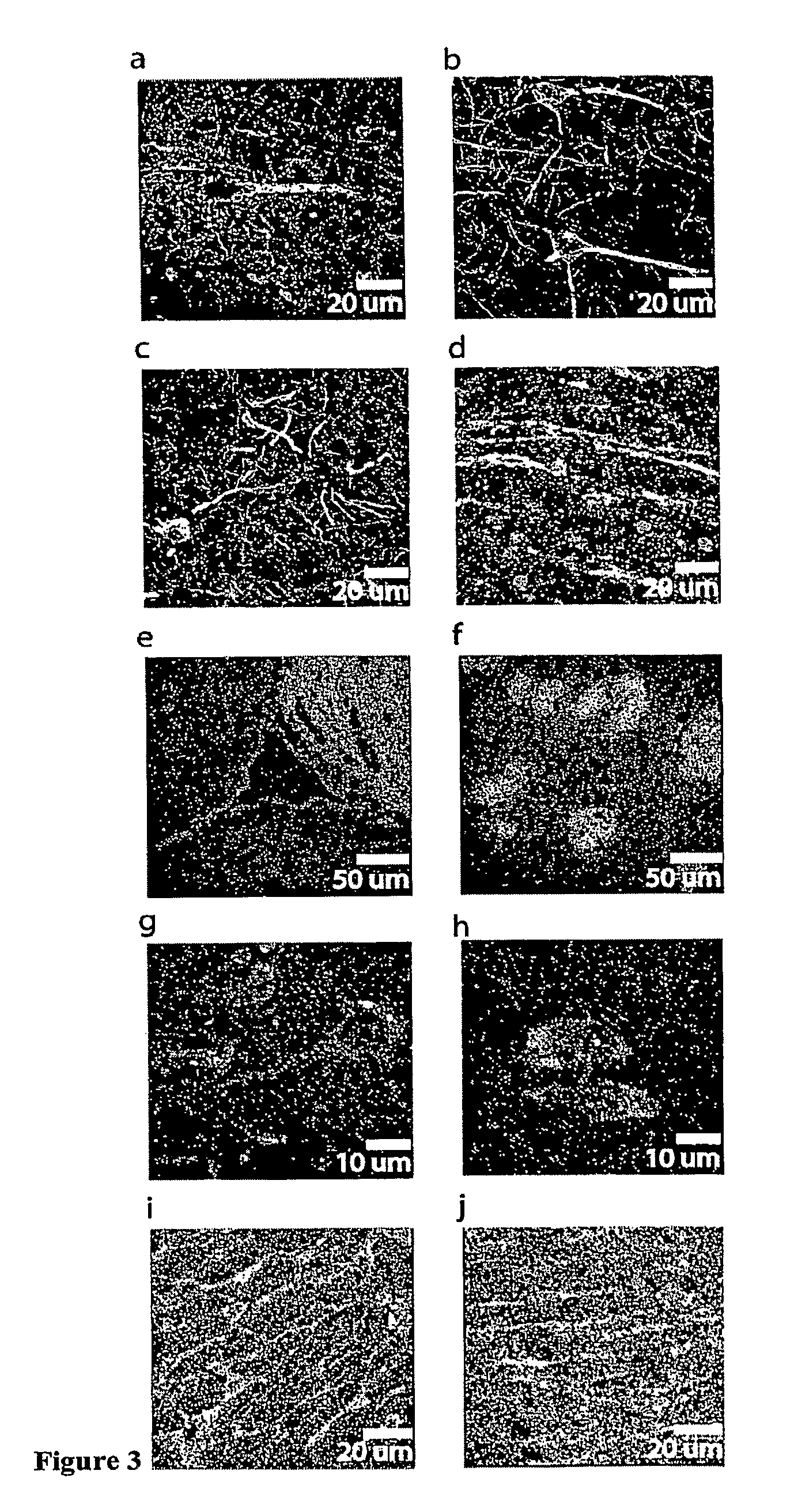 Tissue Sample Preparation and MALDI MS Imaging Thereof