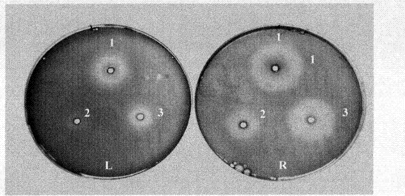 Application of earthworm fibrinolytic enzyme in resistance to liver fibrosis