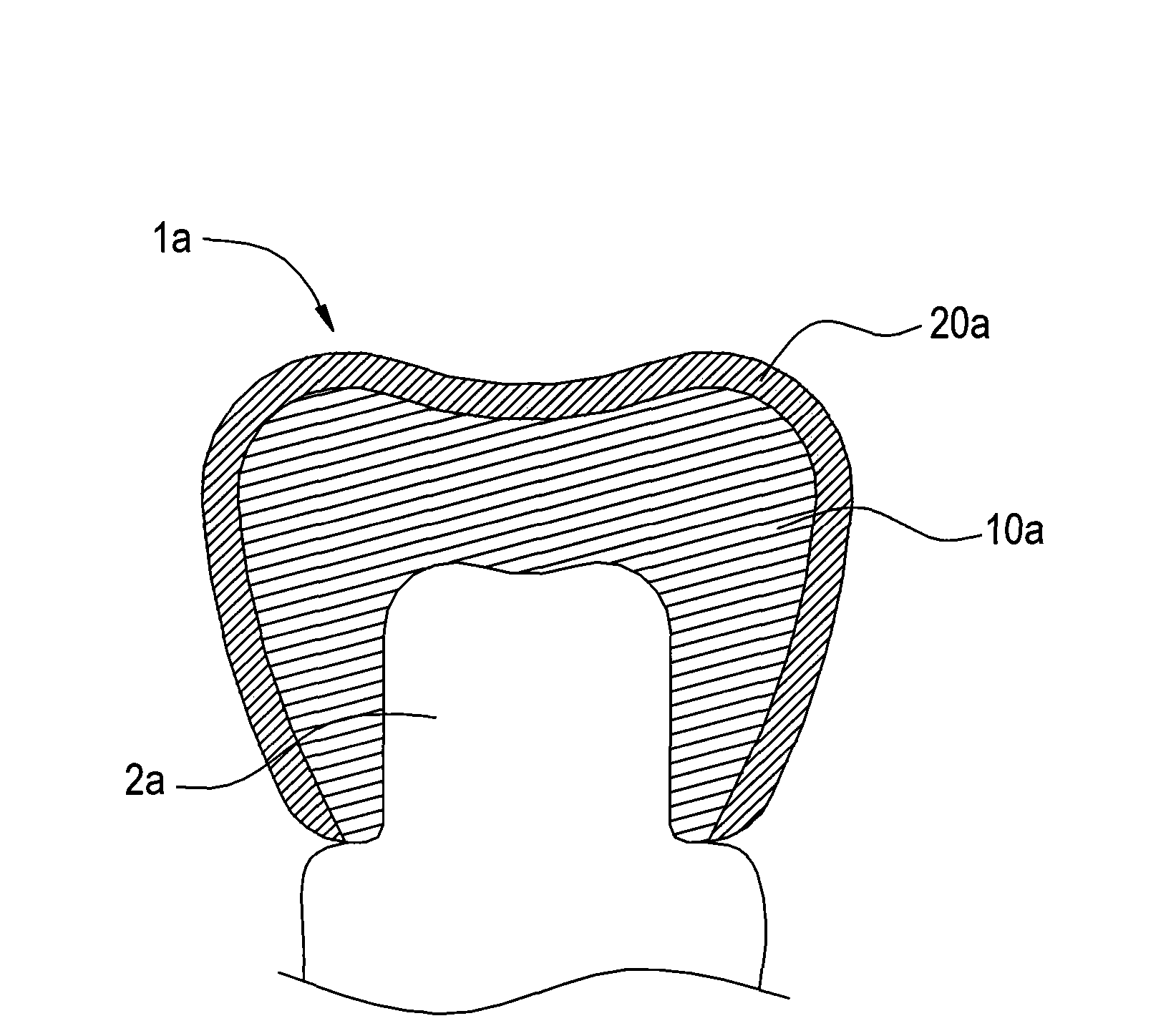 Oral dental material structure with high chaining force