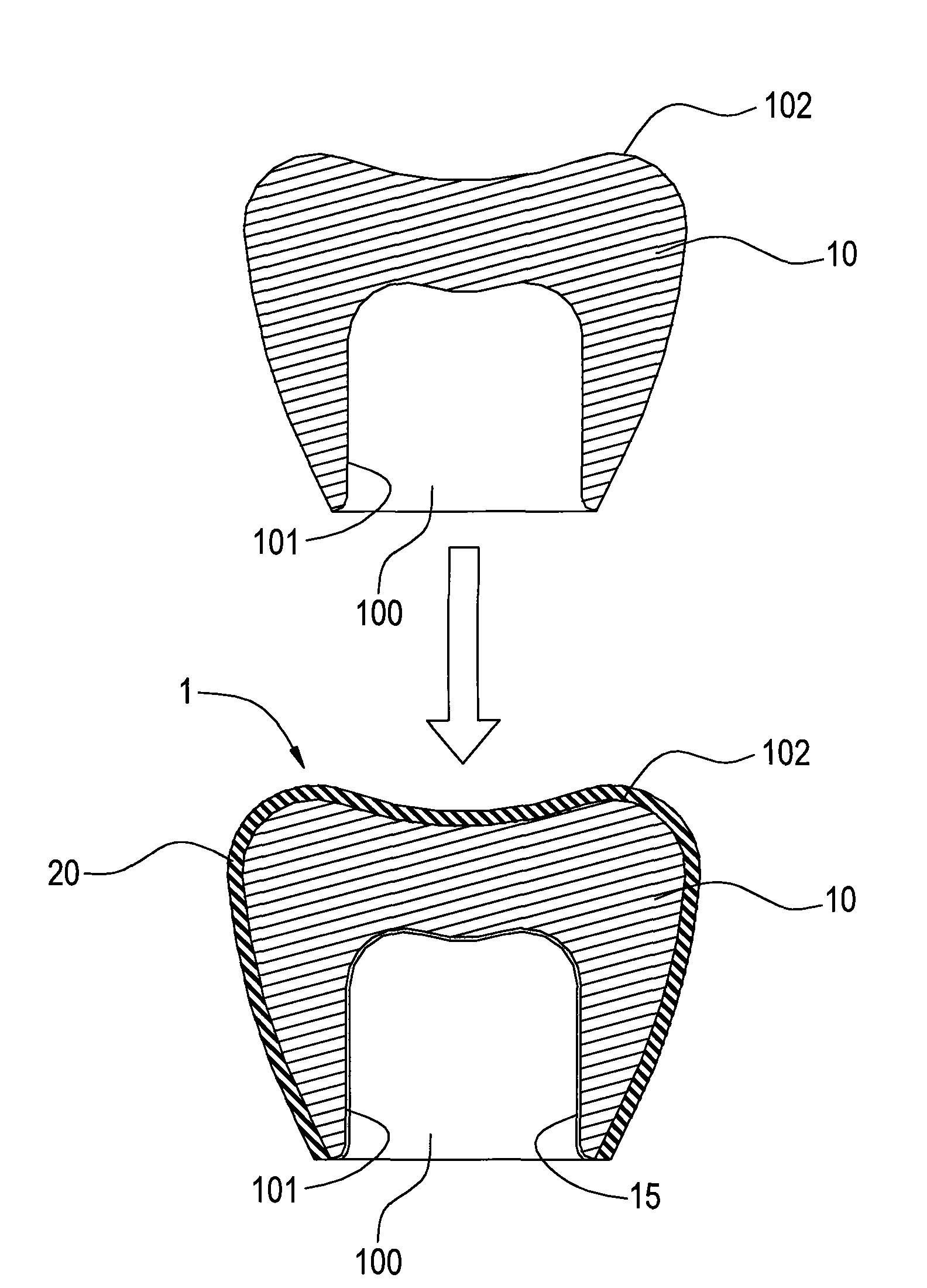 Oral dental material structure with high chaining force