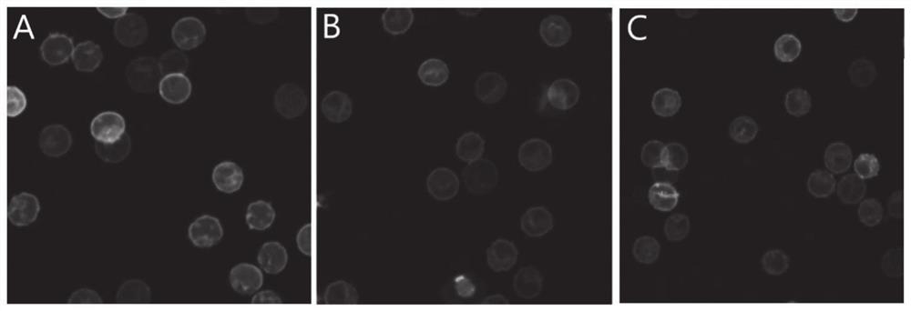 Application of heparin iron in preparation of medicine for treating renal anemia