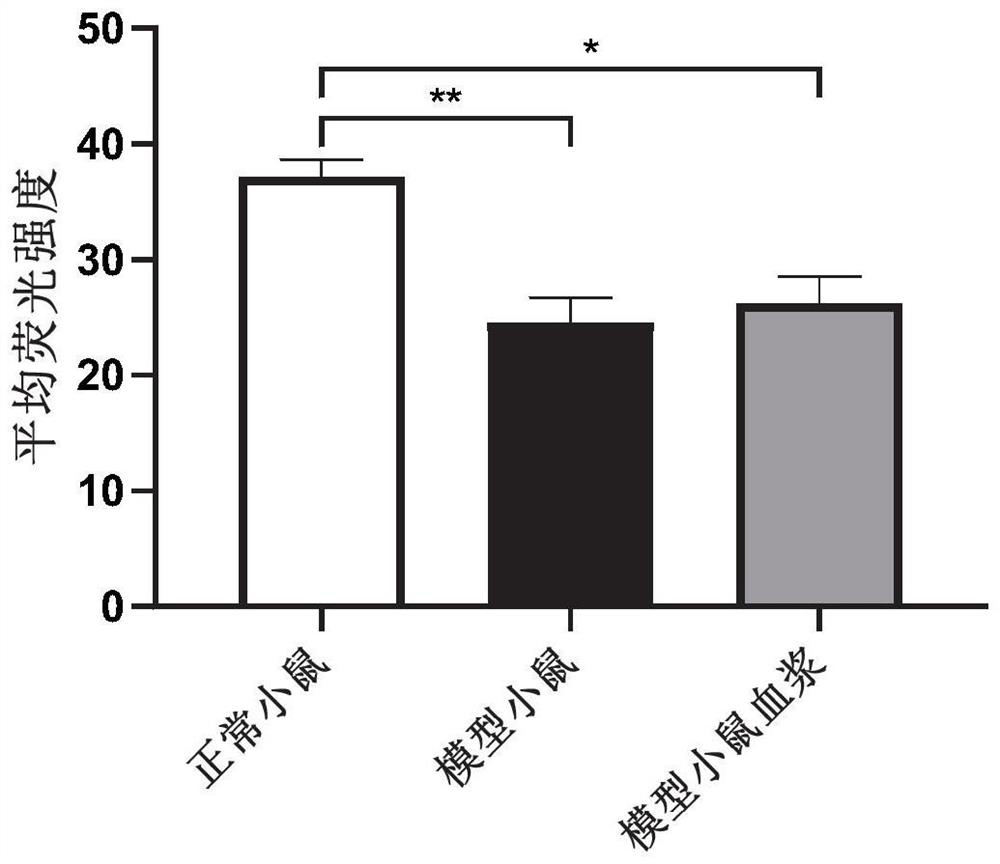 Application of heparin iron in preparation of medicine for treating renal anemia