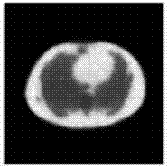 Dynamic PET (Positron Emission Tomography) image reconstruction and tracing kinetic parameter estimation method based on image segmentation